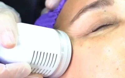 Innovación en cosmiatría facial: Introducción de la Revolucionaria HydraFacial 7 en 1 en laCorporación Dr. Amin Ariza